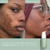 Caudalie Vinopure Blemish Control Salicylic Serum 30ml - Image 5