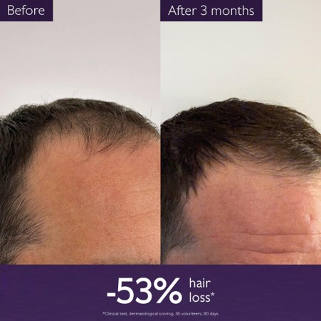 Caudalie Anti-Hair Loss Serum 50ml - Image 2